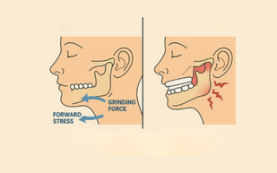 Releasing Tension Can Change Your State