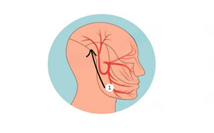 Stress Often Shows Up Physically